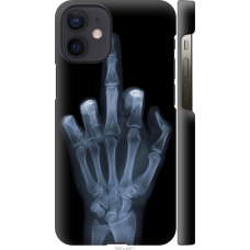 Чохол на iPhone 12 Mini Рука через рентген 1007c-2071