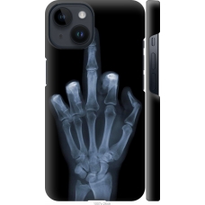 Чохол на iPhone 14 Рука через рентген 1007m-2648