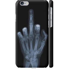 Чохол на iPhone 6s Рука через рентген 1007m-90
