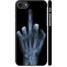Чохол на iPhone 8 Рука через рентген 1007m-1031