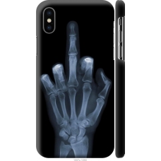 Чохол на iPhone X Рука через рентген 1007m-1050