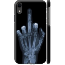 Чохол на iPhone XR Рука через рентген 1007m-1560