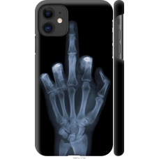 Чохол на iPhone 11 Рука через рентген 1007m-1722