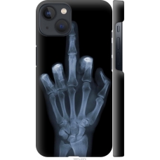 Чохол на iPhone 13 Рука через рентген 1007m-2374