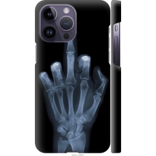 Чохол на iPhone 14 Pro Max Рука через рентген 1007m-2667