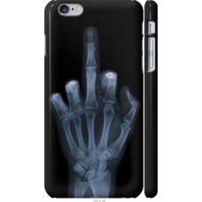 Чохол на iPhone 6 Plus Рука через рентген 1007m-48