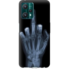 Чохол на Realme 9 Pro Рука через рентген 1007u-2595