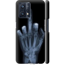 Чохол на Realme 9 Pro Plus Рука через рентген 1007m-2596