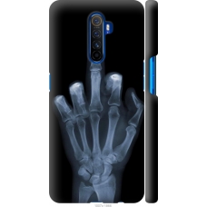 Чохол на Realme X2 Pro Рука через рентген 1007m-1866
