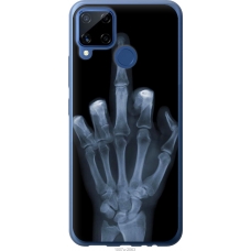 Чохол на Realme C15 Рука через рентген 1007u-2063