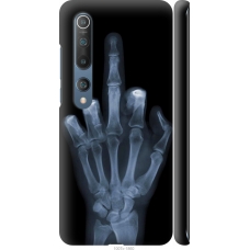 Чохол на Xiaomi Mi 10 Pro Рука через рентген 1007m-1870
