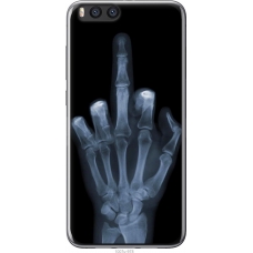Чохол на Xiaomi Mi Note 3 Рука через рентген 1007u-978