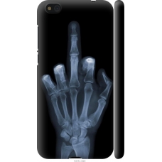 Чохол на Xiaomi Mi5c Рука через рентген 1007m-820