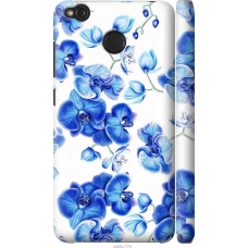 Чохол на Xiaomi Redmi 4X Блакитні орхідеї 4406m-778