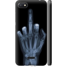 Чохол на Xiaomi Redmi 6A Рука через рентген 1007m-1531