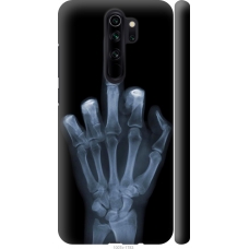 Чохол на Xiaomi Redmi Note 8 Pro Рука через рентген 1007m-1783