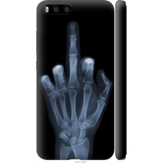 Чохол на Xiaomi Mi6 Рука через рентген 1007m-965