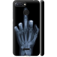 Чохол на Xiaomi Redmi 6 Рука через рентген 1007m-1521