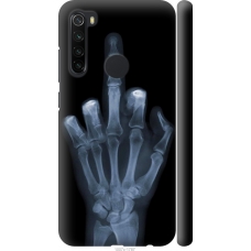Чохол на Xiaomi Redmi Note 8 Рука через рентген 1007m-1787