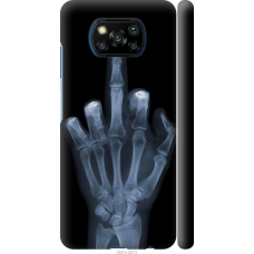 Чохол на Xiaomi Poco X3 Рука через рентген 1007m-2073