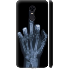 Чохол на Xiaomi Redmi 5 Plus Рука через рентген 1007m-1347