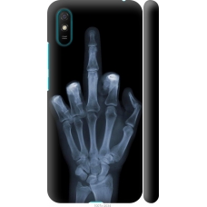 Чохол на Xiaomi Redmi 9A Рука через рентген 1007m-2034