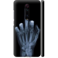 Чохол на Xiaomi Mi 9T Рука через рентген 1007m-1815