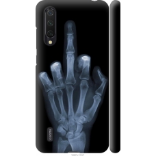 Чохол на Xiaomi Mi CC9 Рука через рентген 1007m-1747