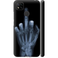 Чохол на Xiaomi Redmi 9C Рука через рентген 1007m-2035
