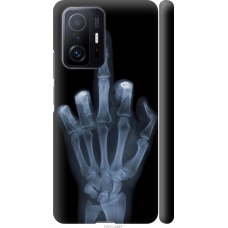 Чохол на Xiaomi 11T Рука через рентген 1007m-2487