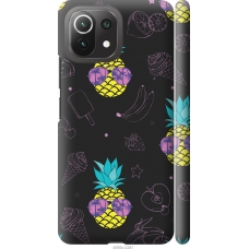 Чохол на Xiaomi Mi 11 Lite Summer ananas 4695m-2281