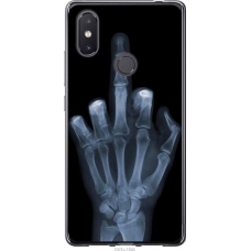 Чохол на Xiaomi Mi8 SE Рука через рентген 1007u-1504