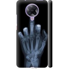 Чохол на Xiaomi Redmi K30 Pro Рука через рентген 1007m-1899