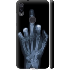 Чохол на Xiaomi Mi Play Рука через рентген 1007m-1644