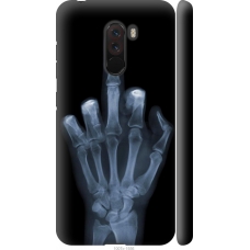 Чохол на Xiaomi Pocophone F1 Рука через рентген 1007m-1556