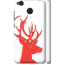 Чохол на Xiaomi Redmi 4X Oh My Deer 2527m-778