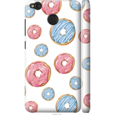 Чохол на Xiaomi Redmi 4X Donuts 4422m-778