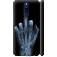 Чохол на Xiaomi Redmi 8 Рука через рентген 1007m-1806