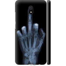 Чохол на Xiaomi Redmi 8A Рука через рентген 1007m-1794