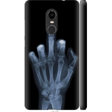 Чохол на Xiaomi Redmi Note 4X Рука через рентген 1007m-951