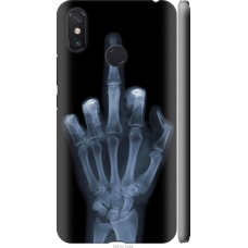 Чохол на Xiaomi Mi Max 3 Рука через рентген 1007m-1534