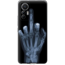 Чохол на Xiaomi 12 Lite Рука через рентген 1007u-2579