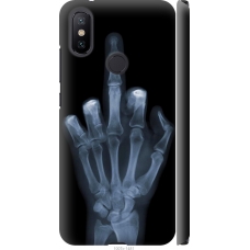 Чохол на Xiaomi Mi A2 Рука через рентген 1007m-1481