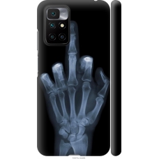Чохол на Xiaomi Redmi 10 Рука через рентген 1007m-2488