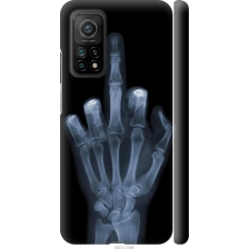 Чохол на Xiaomi Mi 10T Pro Рука через рентген 1007m-2679