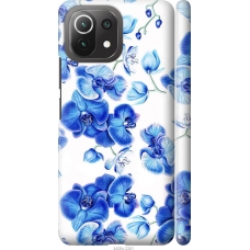 Чохол на Xiaomi Mi 11 Lite Блакитні орхідеї 4406m-2281